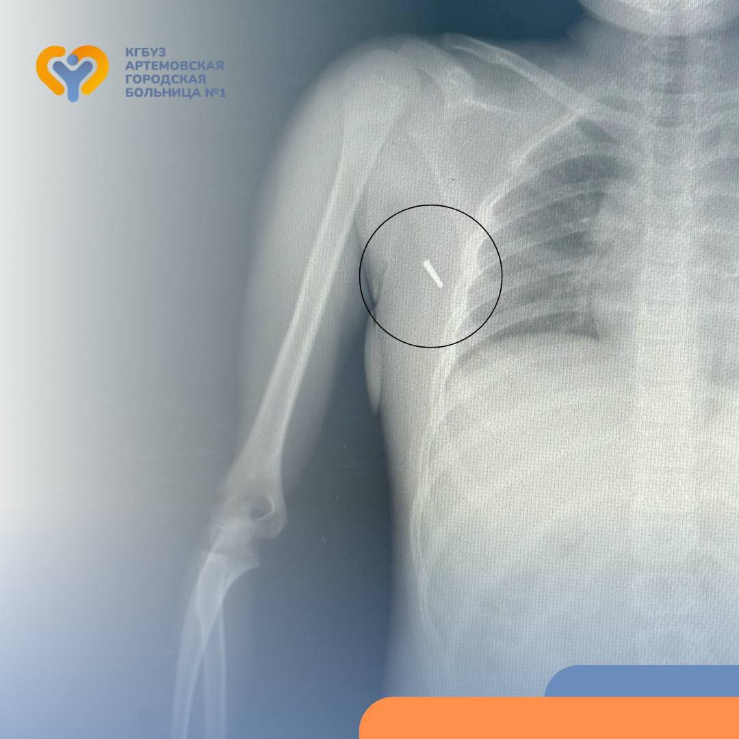 Неподходящее место