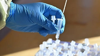 Число заражений коронавирусом в мире за месяц увеличилось на 80%